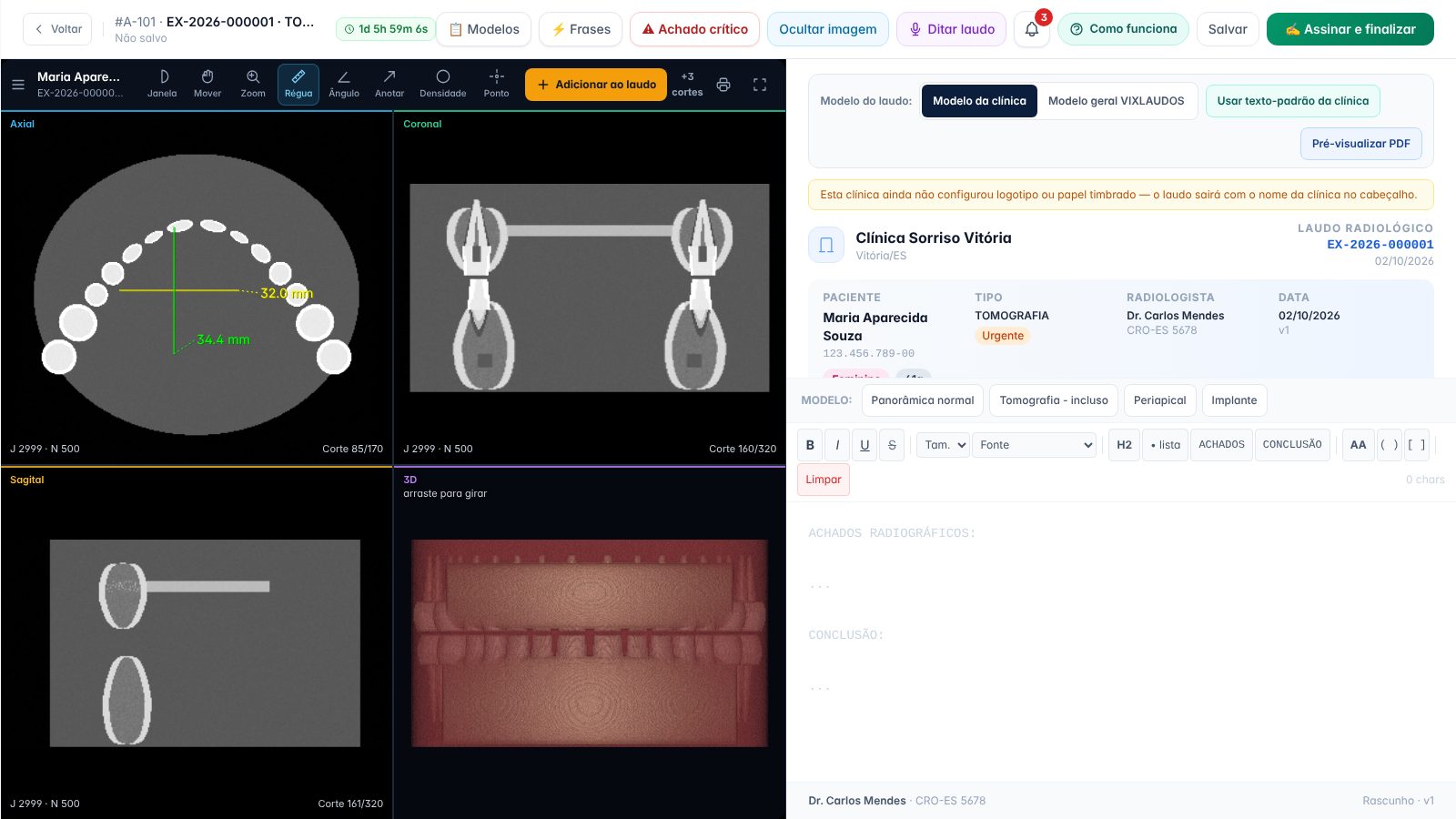 Tela do editor de laudo com tomografia em cortes axial, coronal, sagital e 3D, com medidas em milímetros
