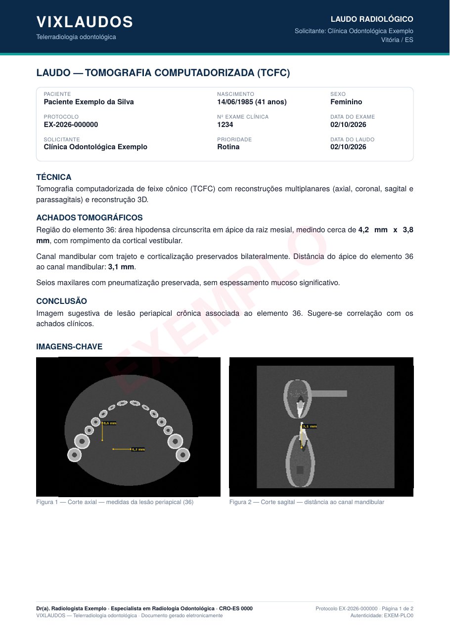 Exemplo de laudo de tomografia em PDF com imagens e medidas